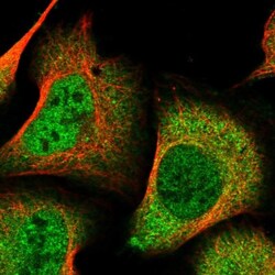 DDI2 Antibody, Novus Biologicals:Antibodies:Primary Antibodies